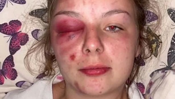 Read more about the article Mum of teen who lied about being raped by Asian gang has NOT returned £22k donated